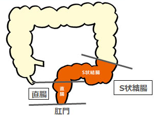 S状結腸内視鏡（S状結腸カメラ）