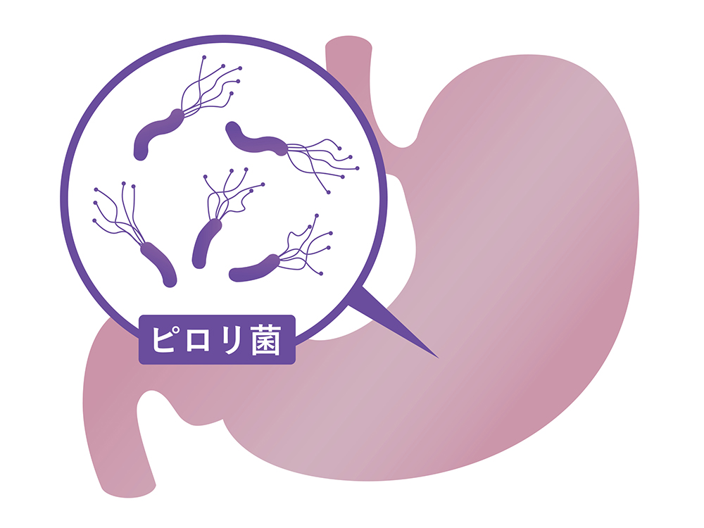 血液ピロリ菌抗体